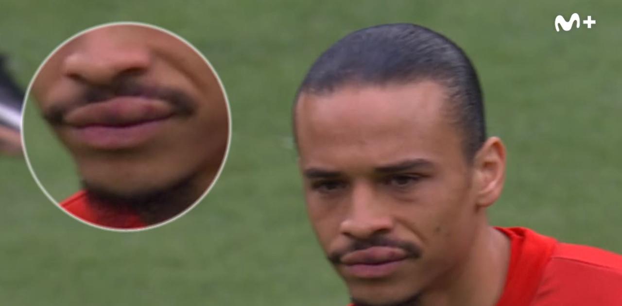 Sane's lip after Mane punch