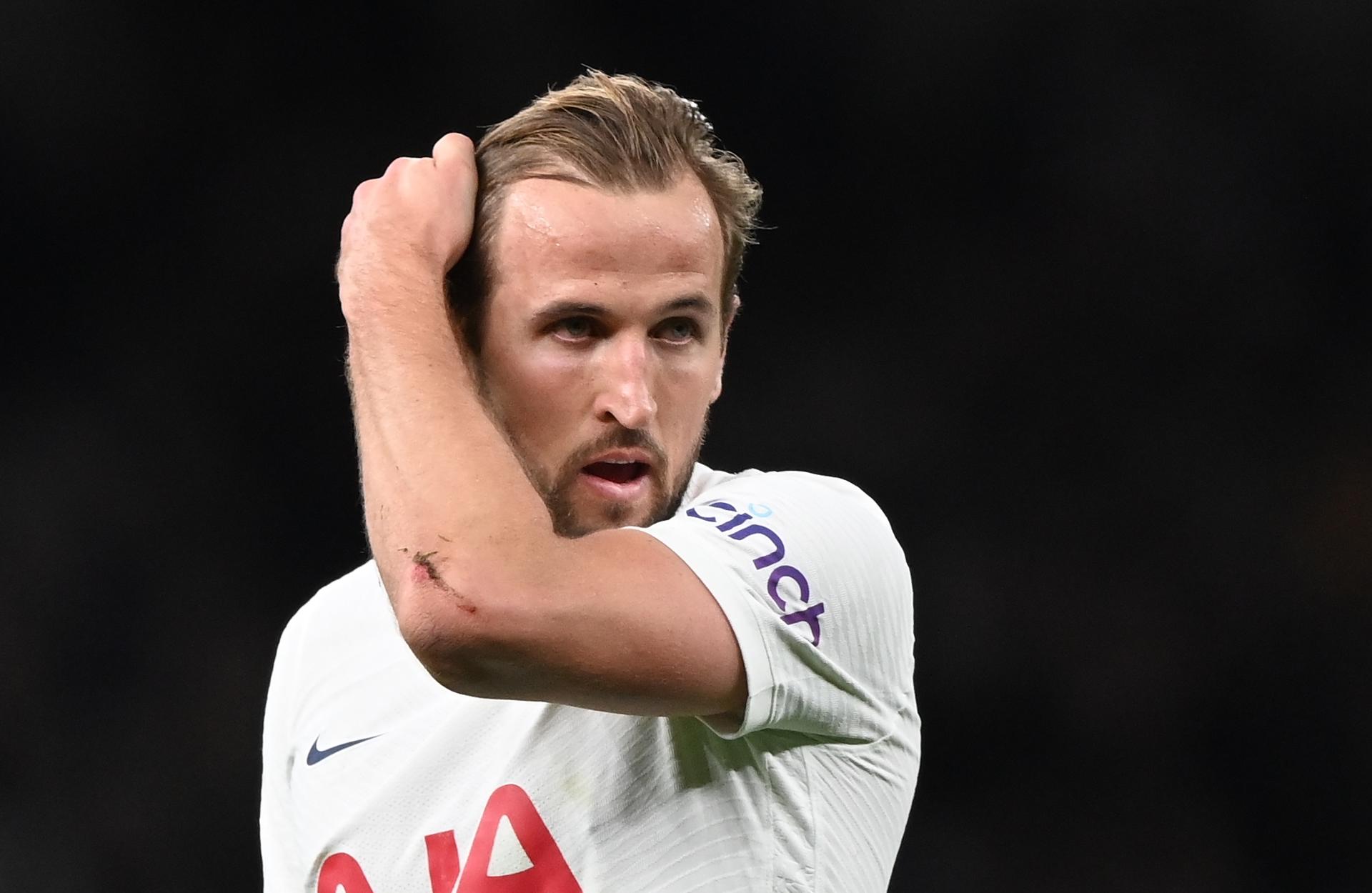 Spurs to follow same plan with Kane as PSG did with Mbappe